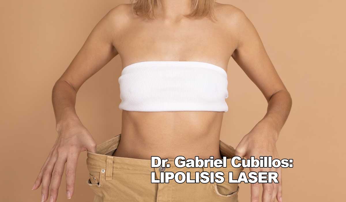 Dr. Gabriel Cubillos: Lipolisis láser y sus beneficios